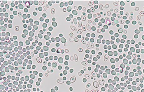 Researchers have restructured the entire yeast genome and packed it into one ‘super chromosome’