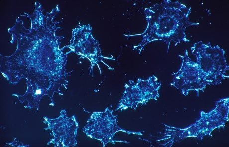 Klinische Studie: Neue Immuntherapie gegen Krebs