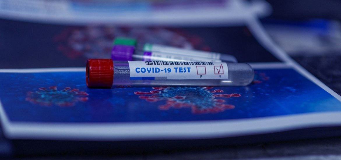 Covid-19 : les personnes antérieurement contaminées par le virus sont plus protégées contre une réinfection 