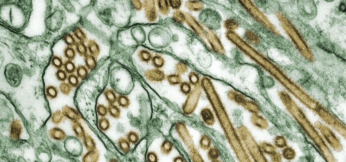 Viren als Auslöser für Neurodegenerative Erkrankungen