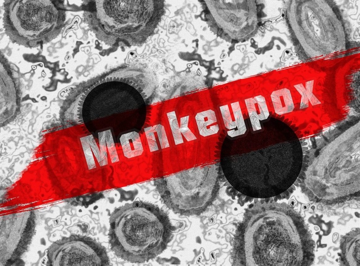 Another Infectious Disease Threat: Mpox Makes A Comeback